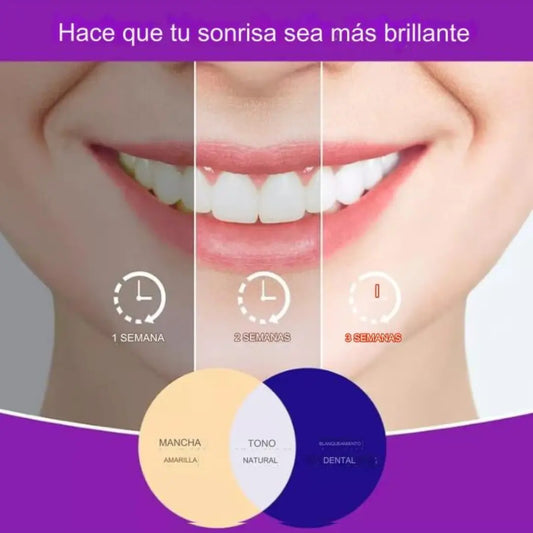 SmileKit Sonrisa Brillante - Espuma Blanqueadora