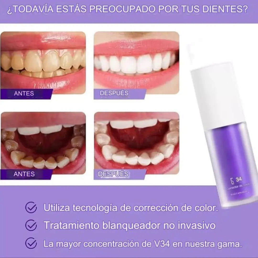 SmileKit Sonrisa Brillante - Espuma Blanqueadora